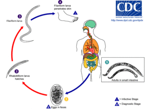 Ankylostomatoza