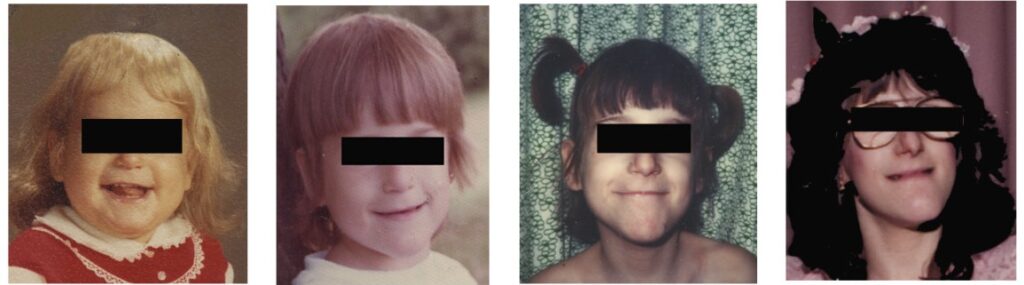 Rodzinna dysautonomia